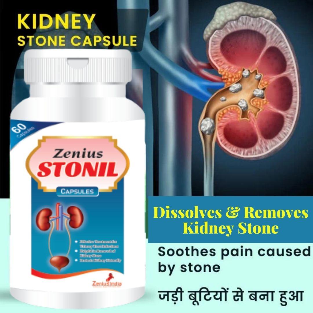 Zenius Stonil Capsule for Kidney Stone Removal Medicine | Kidney StoneZenius Stonil Capsule is the best Ayurvedic Medicine for Kidney Stone is precisely made for those who are looking for a treatment that can give them long term freedoGeneral WellnessZenius IndiaKidney Stone Treatment (60 Capsules)