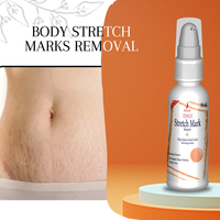 Zenius Stretch Mark Oil for All Skin Types-50ML Oil - Zenius India