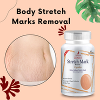 Zenius Stretch mark capsule for Body Stretch Marks Removal Medicine-60 Capsules - Zenius India