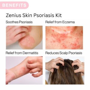 Zenius Skin Psoriasis Care Kit - Image 4