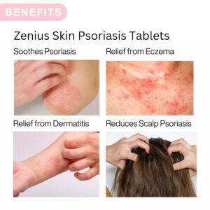 Zenius Skin Psoriasis Care - Image 5