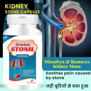 Zenius Stonil Capsule for Kidney Stone Removal Medicine | Kidney Stone Treatment (60 Capsules) - Image 6