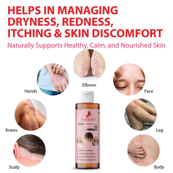 Zenius Skin Psoriasis Care Oil - Image 2