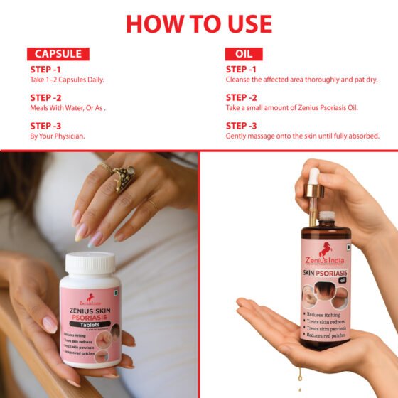 Zenius Skin Psoriasis Care Kit - Image 5