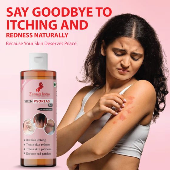 Zenius Skin Psoriasis Care Oil - Image 1