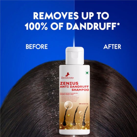Zenius Anti Dandruff shampoo - Image 5
