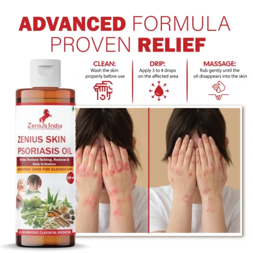 Zenius Psoriasis Care Oil - Image 5