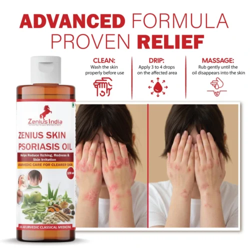 Zenius Psoriasis Combo Kit - Image 5