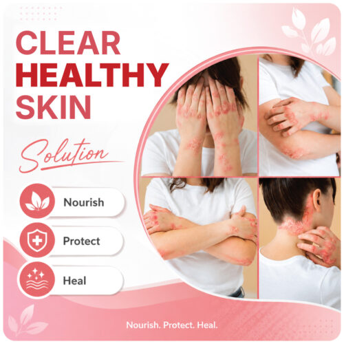4 Zenius Skin Psoriasis Care Tablet - Supplement For Psoriasis Eczema Itchy Flaky Skin & Skin Allergies | Reduces Inflammation & Promotes Clearer & Healthier Skin | 60 Tablets