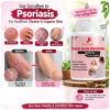 5 Zenius Skin Psoriasis Care Tablet - Supplement For Psoriasis Eczema Itchy Flaky Skin & Skin Allergies | Reduces Inflammation & Promotes Clearer & Healthier Skin | 60 Tablets