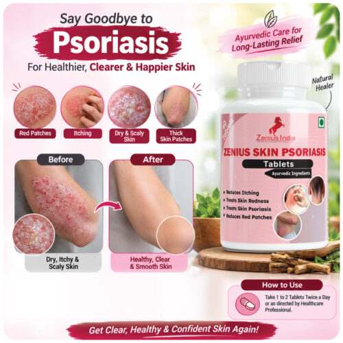 5 Zenius Skin Psoriasis Care Tablet - Supplement For Psoriasis Eczema Itchy Flaky Skin & Skin Allergies | Reduces Inflammation & Promotes Clearer & Healthier Skin | 60 Tablets