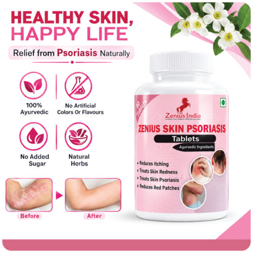 8 Zenius Skin Psoriasis Care Tablet - Supplement For Psoriasis Eczema Itchy Flaky Skin & Skin Allergies | Reduces Inflammation & Promotes Clearer & Healthier Skin | 60 Tablets