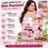 Benefits Image 1 Zenius Skin Psoriasis Kit
