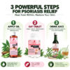 psoriasis-kit psoriasis-kit