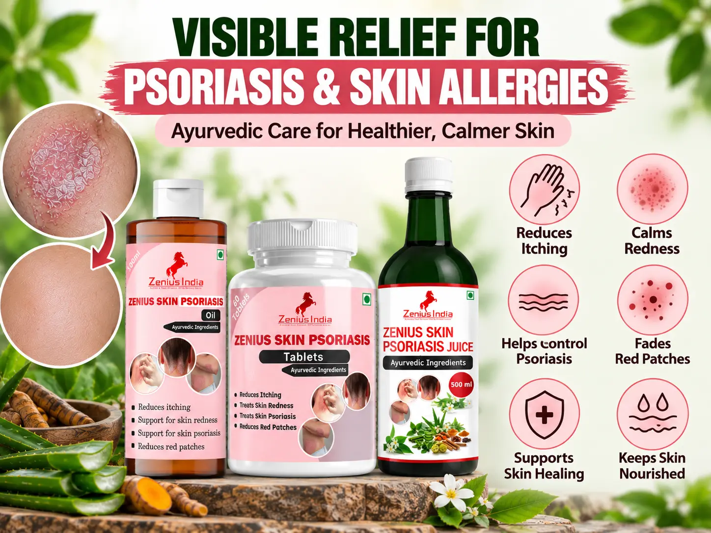 Zenius Skin Psoriasis & Eczema Relief Kit For Body & Scalp | Steroid-Free 3-in-1 Ayurvedic Combo (Oil + Tablets + Juice) | Helps With Dryness, Redness, Itching, Flaky Skin & Irritation 5 Benefits Banner Mobile View 2 Zenius India